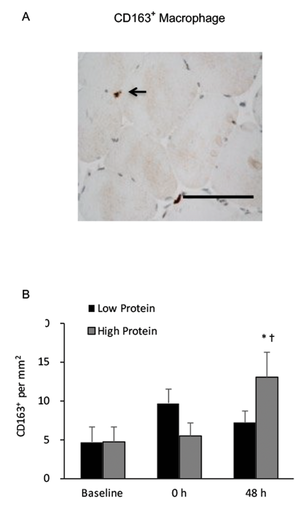 Regenerative macrophage (CD163+) in human skeletal muscle after resistance exercise. (A) Representative immunohistochemical staining of a muscle cross-section (CD163+ macrophage indicated by an arrow). Scale bar 100 μm. (B) High protein supplementation before and after resistance exercise increased CD163+ macrophage presence in human skeletal muscle 48 h after exercise. * Significant difference against Baseline, P 