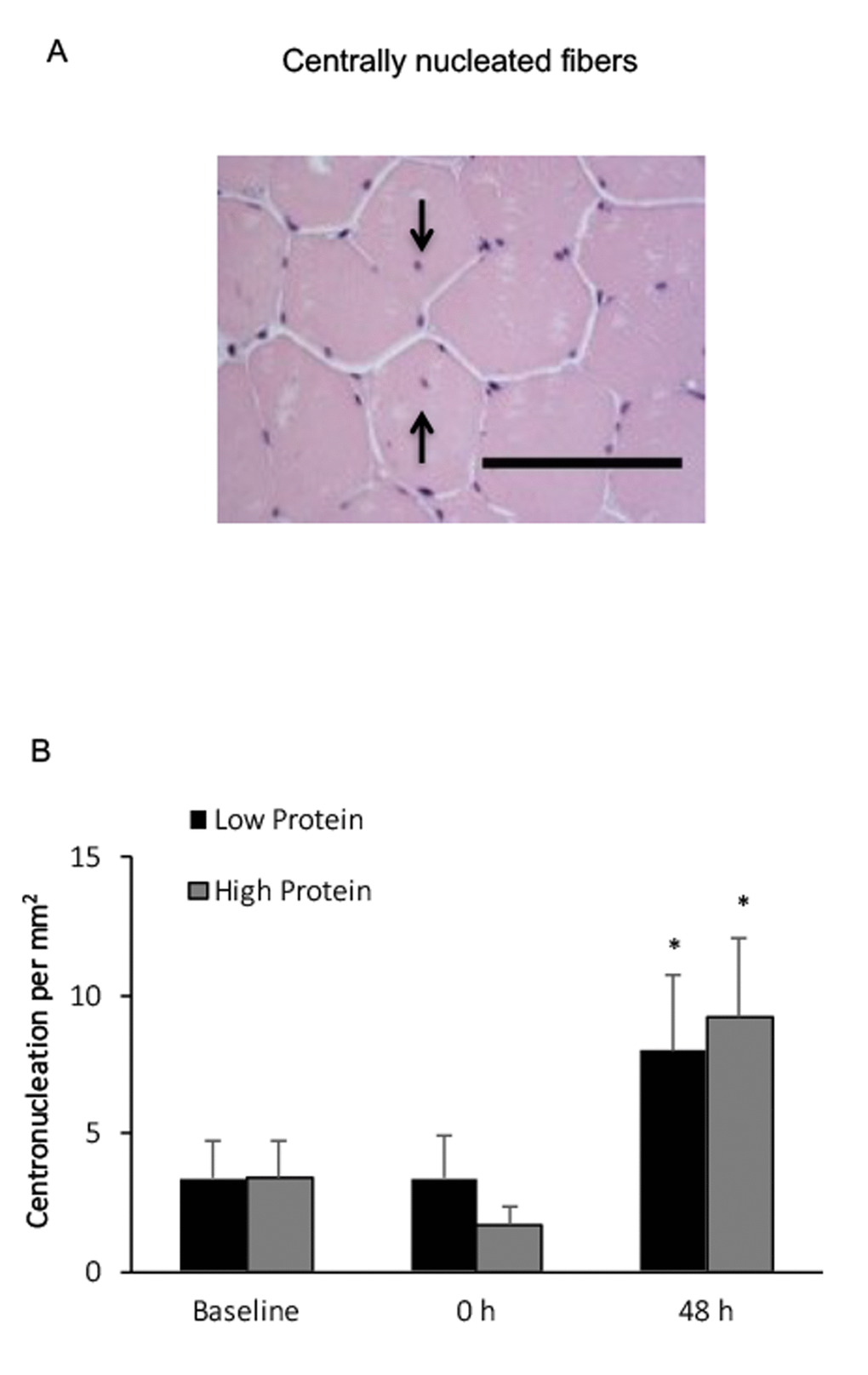 Centrally nucleated fibers in human skeletal muscle after resistance exercise. (A) Representative hematoxylin and eosin staining of a muscle cross-section (centrally nucleated fibers indicated by arrows). Scale bar 100 μm. (B) (††) No difference between Low and High protein trials was found. * Significant difference against Baseline, P 