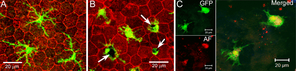 Subretinal macrophages in the aging eye. RPE/choroidal flatmount from 18 months (A) and 24 months (B) old CX3CR1gfp/+ mice were stained with phalloidin and imaged by confocal microscopy. Arrows - pigmented debris in subretinal macrophages. (C), RPE/choroidal flatmount from a 24 month old CX3CR1gfp/+ mouse was imaged by confocal microscopy. Green – GFP+ subretinal macrophages; Red – autofluorescence (AF).