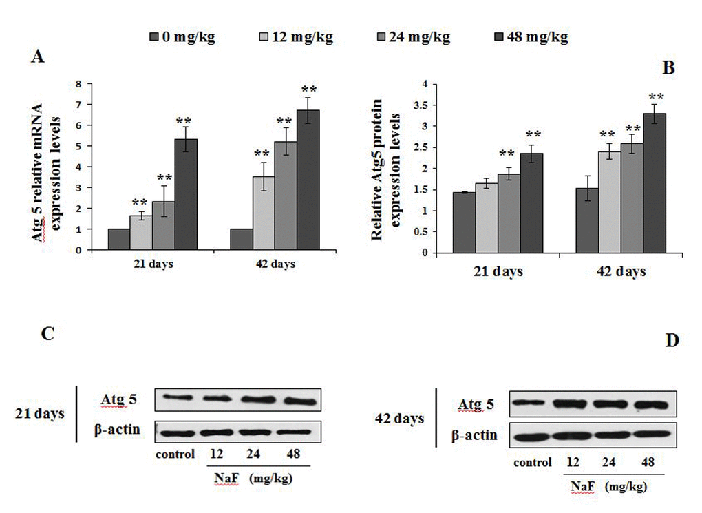 Changes of mRNA and protein expression levels of Atg5 in the spleen at 21 and 42 days of the experiment. (A) The relative mRNA expression levels. (B) The relative protein expression levels. (C, D) The western blot assay. Data are presented with the mean + standard deviation (n=8), *p p 