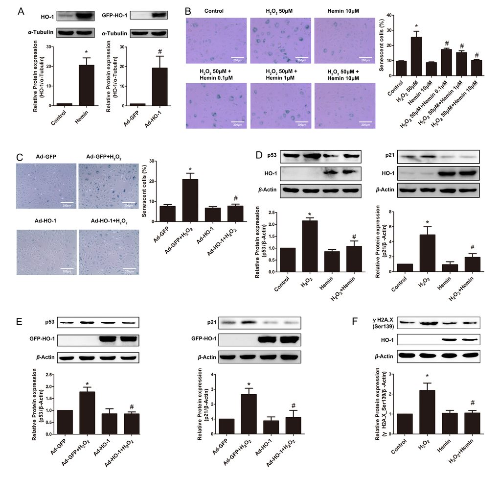 Induction or overexpression of HO-1 reversed HUVEC senescence. (A) Upregulation of HO-1 protein expression in HUVEC induced by Hemin or transfected with HO-1 recombinant adenovirus (HO-1, 32kDa; GFP-HO-1, 59kDa). *P #P B) HUVEC were stained for SA-β-galactosidase treated with H2O2 (50 μM, 1 h) or/and Hemin (0.1-10 μM). Senescent cells appeared blue (200 × magnification). *P #P 2O2. n = 5. (C) SA-β-gal staining of HUVEC treated with H2O2 (50 μM, 1 h) or/and HO-1 recombinant adenovirus (200 × magnification). *P #P 2O2. n = 5. (D) Hemin attenuated the expression of p53 or p21 stimulated by H2O2. *P #P 2O2. n = 5. (E) Overexpression of HO-1 infected by recombinant adenovirus decreased the upregulation of p53 or p21 stimulated by H2O2. *P #P 2O2. n = 5. (F) Hemin attenuated the expression of γH2A.X (Ser139) stimulated by H2O2. *P #P 2O2. n = 5.