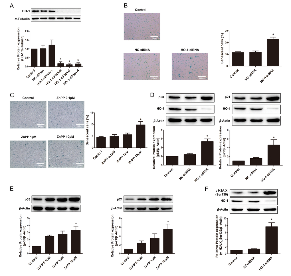 Endogenous depletion or suppression of HO-1 promoted HUVEC senescence. (A) Screening of HO-1 interference sequences by Western blotting. Sequence-3 was used for the following experiments. *P B) SA-β-gal staining of HUVEC transfected with HO-1 siRNA (200 × magnification). *P C) SA-β-gal staining after treating with different concentration of ZnPP (0.1, 1 or 10 μM) (200 × magnification). *P D) Silencing of HO-1 increased the expression of p53 or p21. *P E) HO-1 inhibitor ZnPP increased the expression of p53 or p21. *P F) Silencing of HO-1 increased the expression of γH2A.X(Ser139). *P 