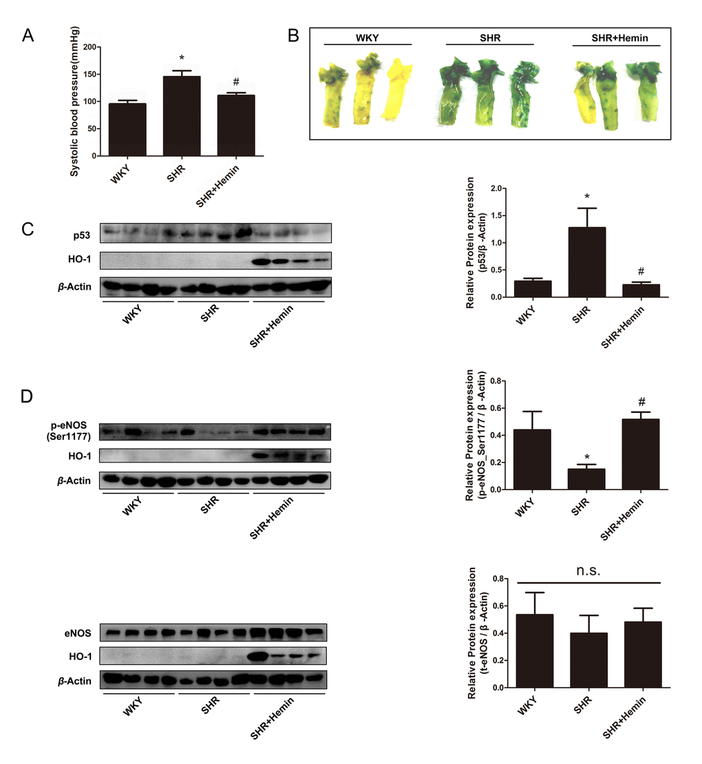 HO-1 alleviated endothelial senescence through regulating phosphorylation status of eNOS at Ser1177 in SHRs. (A) Upregulation of HO-1 reduced blood pressure in the SHR. *P #P B) SA-β-gal staining of the aortas originated from WKYs, SHRs, and SHRs treated with Hemin. (C) Hemin attenuated the high expression of p53 in the SHR. *P #P D) Hemin increased the downregulation of p-eNOS (Ser1177) in SHRs, while had no effect on the expression of eNOS. *P #P 