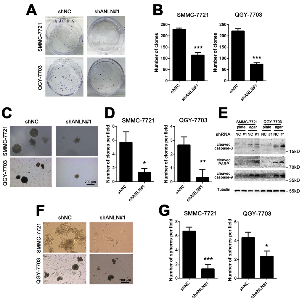 ANLN expression is required for HCC cell growth. (A) Representative images of colony formation assays of SMMC-7721 and QGY-7703 cells after ANLN depletion. (B) Quantification of the colony numbers in (A). (C) Representative images of soft agar assays of SMMC-7721 and QGY-7703 cells after ANLN depletion. (D) Quantification of the colony numbers in (C). (E) Western blotting analysis of the expression levels of cleaved caspase-3, cleaved PARP and cleaved caspase-9 in ANLN knockdown and control cells derived from plate and soft agar colonies. (F) Representative images of the sphere formation assay of SMMC-7721 and QGY-7703 cells after ANLN depletion. (G) Quantification of the spherical colony numbers in (f). ***P 