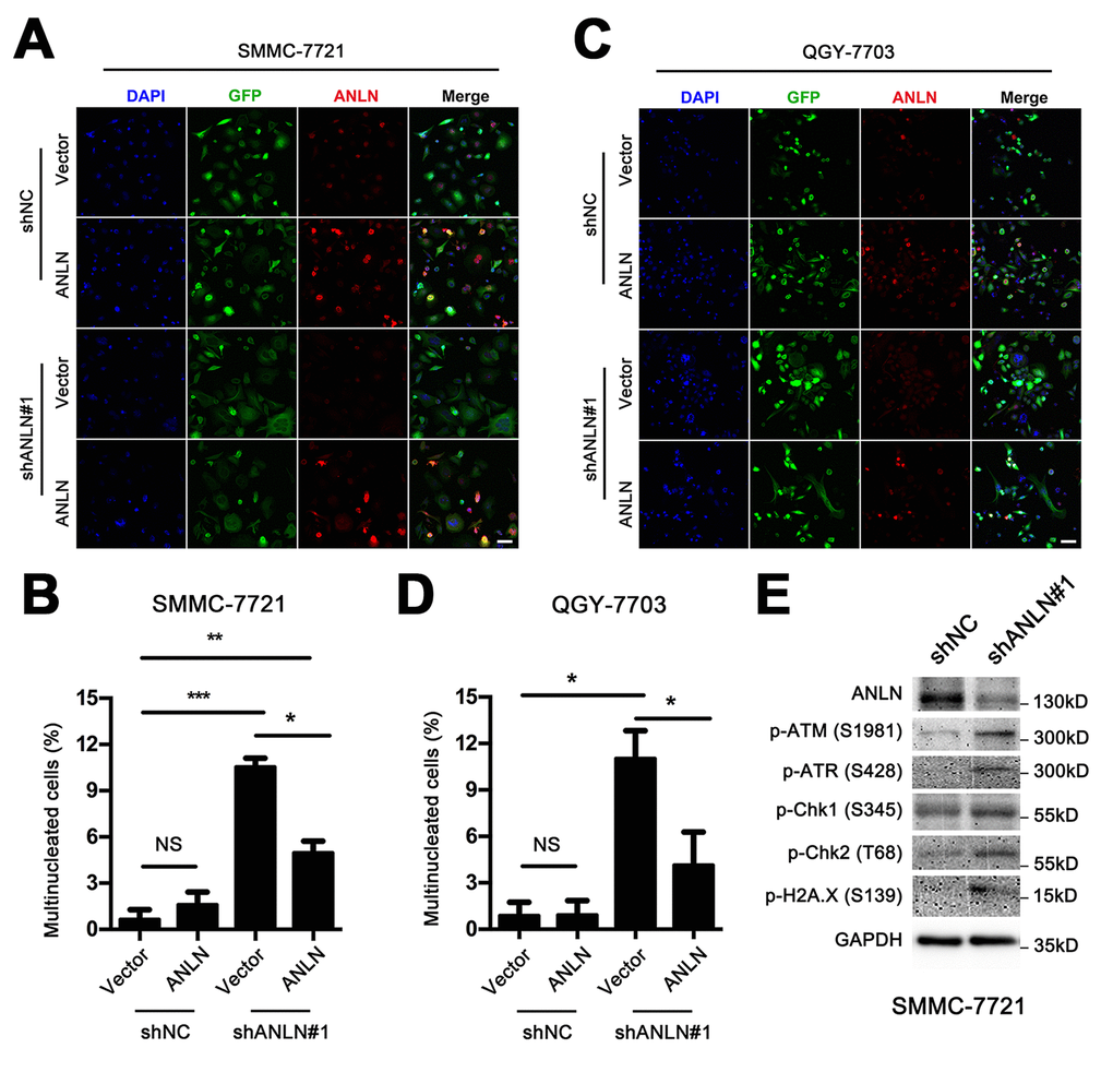 ANLN depletion leads to poly-nucleated morphology and DNA damage in HCC cells. (A) Representative images of the immunofluorescence analysis of ANLN depletion and reconstitution in SMMC-7721 cells. DAPI stains the nucleus with blue fluorescence and GFP indicates the cell shape with green fluorescence. ANLN is shown in red fluorescence. Scale bar: 50 μm. (B) Quantification of the percentages of multinucleated cells in (A). (C) Representative images of immunofluorescence analysis of ANLN depletion and reconstitution in QGY-7703 cells. (D) Quantification of the percentages of multinucleated cells in (C). (E) Western blotting analysis of the expression levels of phosphorylated ATM (Ser1981), phosphorylated ATR (Ser428), phosphorylated Chk1 (Ser345), phosphorylated Chk2 (Thr68) and phosphorylated Histone H2A.X (Ser139) in ANLN knockdown and control cells.