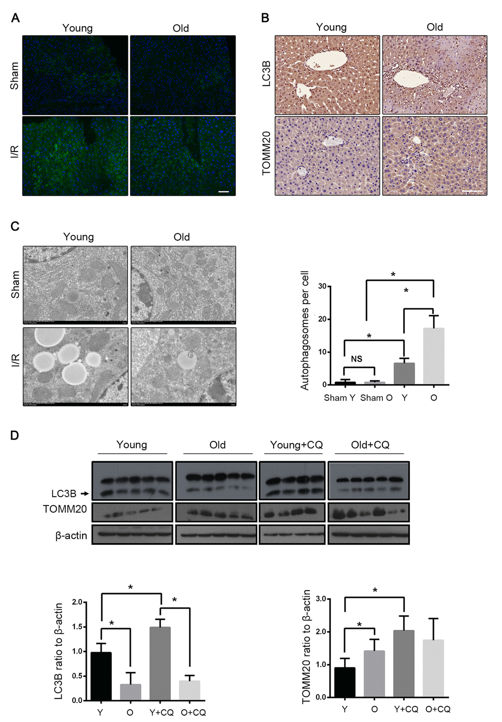 Mitophagy declines with age during hepatic I/R. Mice of different age were treated as indicated (Y for young mice, O for old mice, Y+CQ for young mice with chloroquine pretreatment, O+CQ for old mice with chloroquine pretreatment). (A) Representative images of LC3B staining of liver tissues by fluorescence microscopy. (B) Representative images of LC3B and TOMM20 staining of liver tissues by immunohistochemistry. (C) Representative TEM images of autophagosomes in hepatocytes and quantification of autophagosomes in hepatocytes. (D) The LC3B and TOMM20 protein levels were determined by western blot analysis from the indicated groups. The data are expressed as mean ± SD. Statistical comparisons were performed with t-test. *P 