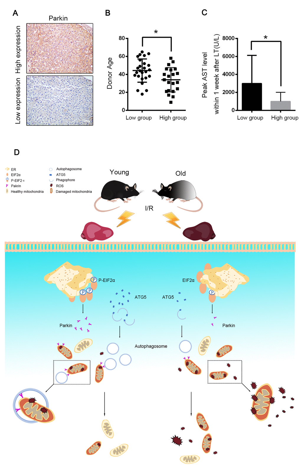 Parkin predicted allograft I/R injury after liver transplantation. 46 graft biopsies were performed 2 hours after complete revascularization in 46 patients undergoing DCD liver transplantation. The data of donor age and peak AST within 7 days after transplantation were collected. (A) Representative images of Parkin expression in liver graft by immunohistochemistry, 21 patients were in Parkin high-expression group and 25 patients were in Parkin-low expression group. Scale bar: 50μm. (B) The donor age of low-expression group was significantly older than high-expression group (44.2±2.6 vs. 34.0±3.0, pC) The peak AST within 7 days after transplantation of low-expression group were significantly higher than high-expression group (2991±624.4 U/L vs. 993.6±221.8 U/L, pD) Aging aggravated hepatic I/R injury by impairing age-dependent mitophagy function via insufficient Parkin and Atg5 expression. Atg5 decreases in old reperfused liver leading to less formation of autophagosomes. Reperfusion of old ischemic mice liver decreases phosphorylation of EIF2α, which in turn inhibits Parkin expression. Reduced parkin expression and autophagosomes formation subsequently impairs mitophagy and promotes onset of the MPT and cell death. Atg5 and Parkin deficiency is responsible for age-dependent mitophagy impairment.