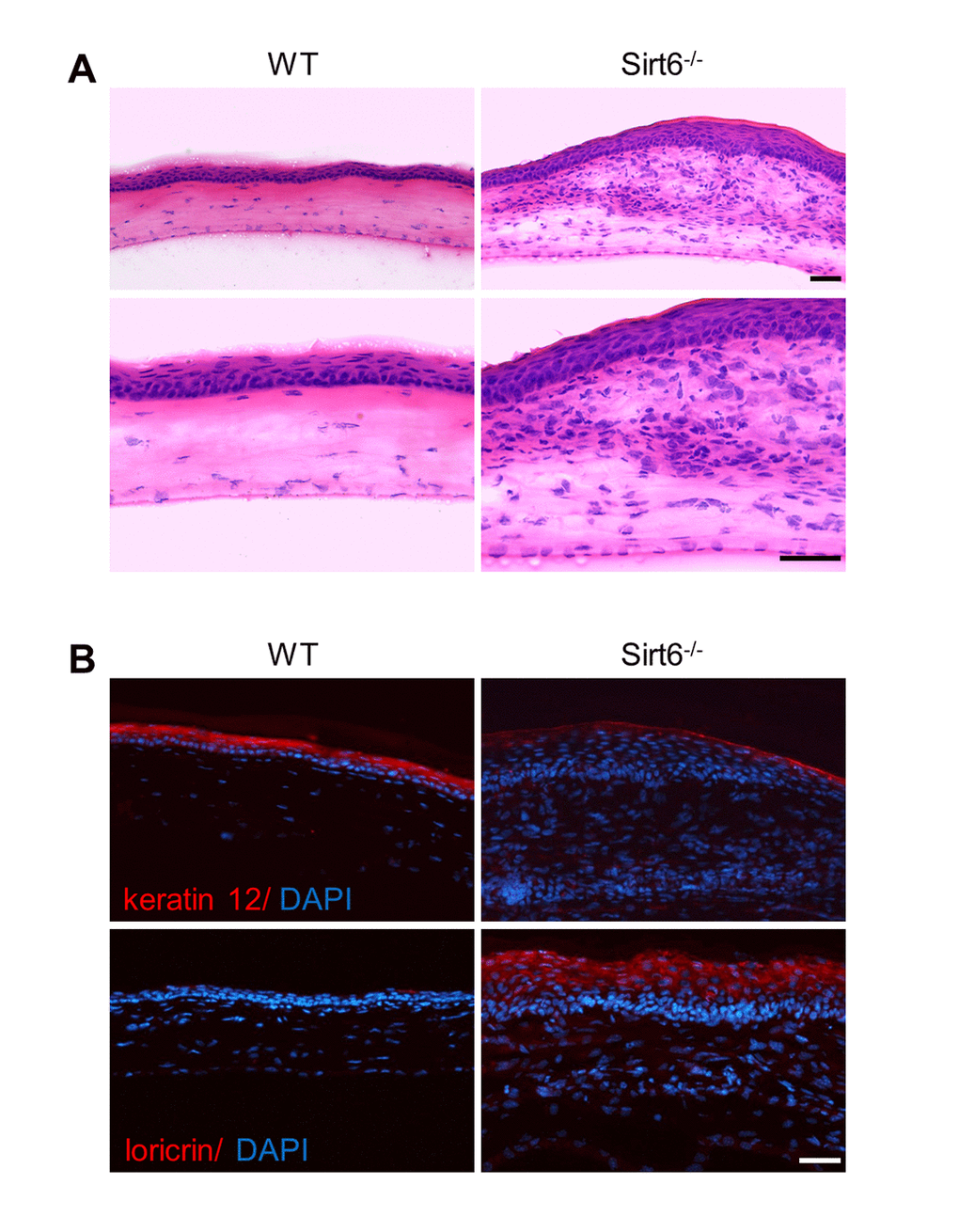 Pathological changes of the cornea of Sirt6 KO mice after injury. 2.0 mm central corneal epithelial debridement wounds were induced in 8-week-old WT and Sirt6 KO mice and eyes were collected 3 weeks after injury. (A) Histological appearance of corneas with H&E staining at 200X magnification (upper panel) and 400X magnification (lower panel). (B) Immunostaining of corneal epithelium marker keratin 12, and the keratinization-related protein loricrin (red) in corneal cryosections from WT and Sirt6 KO mice. Blue: DAPI staining for nuclei. Scale bar: 50 μm.