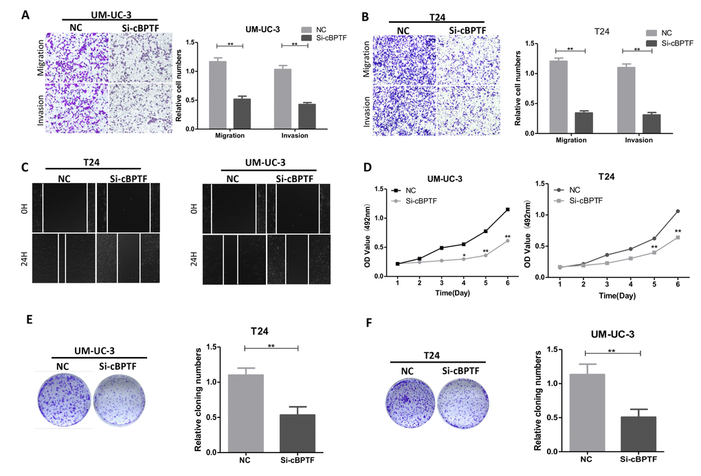 Circ-BPTF promotes progression of BCa cells in vitro. (A, B and C) Effects of circ-BPTF on cell migratory and invasive capabilities were assessed by transwell migration, Matrigel invasion and wound-healing assays. (D-F) MTS and clone-formation assays showed that the proliferative ability was decreased in T24 and UM-UC-3 cells transfected with si-circ-BPTF. Data indicate the means ± SEM. *P