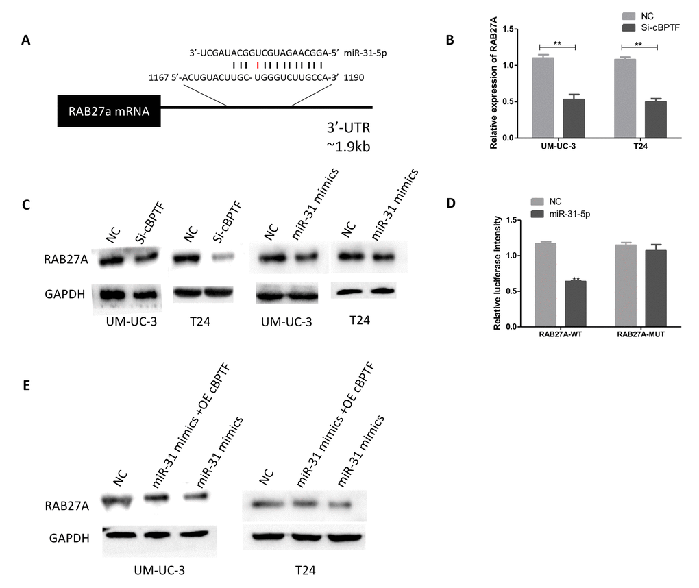 Circ-BPTF promotes BCa proliferation and migration through themiR-31-5p/RAB27A axis. (A) Schematic of predicted miR-31-5p binding sites in the 3’ UTR of RAB27A, with complementary pairs showed in black and mismatches showed in red. (B) Expression levels of RAB27A were detected following knockdown of circ-BPTF by qPCR. (C) Western blotting analysis of RAB27A in BCa cell lines upon knockdown of circ-BPTF and overexpression of miR-31-5p. GAPDH was used as a loading control. (D) miR31-5p decreases the luciferase activities of the wild-type RAB27A 3’ UTR reporter but not the luciferase activities of the mutant RAB27A 3’ UTR reporter. (E) Rescue experiment was performed to analyze RAB27A at protein level by western blotting. GAPDH was used as a loading control. **P