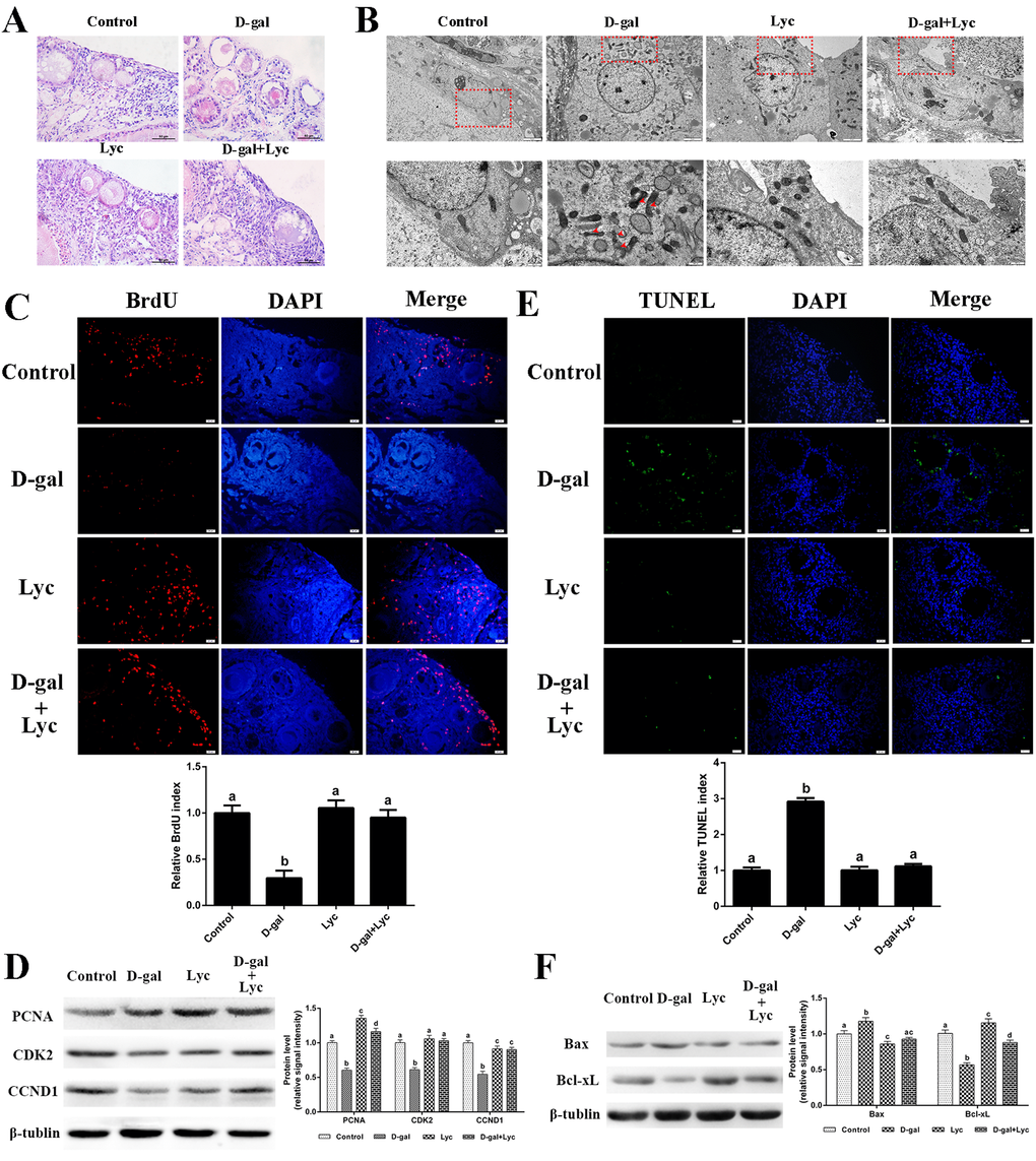 Protective effects of lycopene on D-gal-induced aged ovaries. (A) Effect of lycopene on D-gal-induced morphological changes of ovarian tissues, scale bar: 50 µm. (B) Effect of lycopene on D-gal-induced ultrastructural changes of granulosa cells: the four pictures in the lower row are the higher magnifications of the red squares from the four pictures in the upper row, respectively, scale bar: 2 µm (upper); 1 µm (lower), red arrowheads: fragmented mitochondria. (C) Effect of lycopene on D-gal-induced decline of BrdU index, scale bar: 20 µm; (D) Relative expression of proteins related to cell proliferation. (E) Effect of lycopene on D-gal-induced increase of TUNEL index, scale bar: 20 µm. (F) Relative expression of proteins related to pro-apoptosis (Bax) and anti-apoptosis (Bcl-xL). Values are expressed as the means±s.e.. Different lowercase letters indicate significant differences (P 