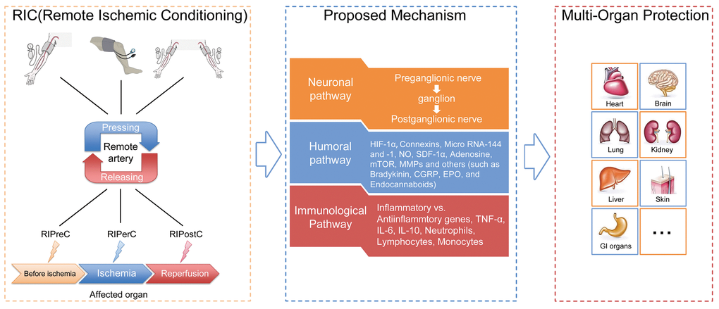 General illustration of remote ischemic conditioning (RIC). Remote ischemic conditioning, in which transient sublethal episodes of ischemia and reperfusion are applied to a limb (upper arm or thigh) or limbs, can be delivered before (remote ischemic preconditioning), during (remote ischemic perconditioning) or after (remote ischemic postconditioning) a subsequent and potentially lethal ischemic attack. Neuronal, humoral as well as immunological mediators are postulated to exert critical roles in the transduction of protective signals generated from limbs and surrounding structures to the targeted organs or tissues. The application of RIC has been extended from initially reducing cardiac infarct sizes resulting from acute myocardial infarction to providing protection for a diversity of organs or tissues (other than the heart), which are likely susceptible to ischemia-reperfusion injury, such as the brain, kidney, lung, liver and skin.