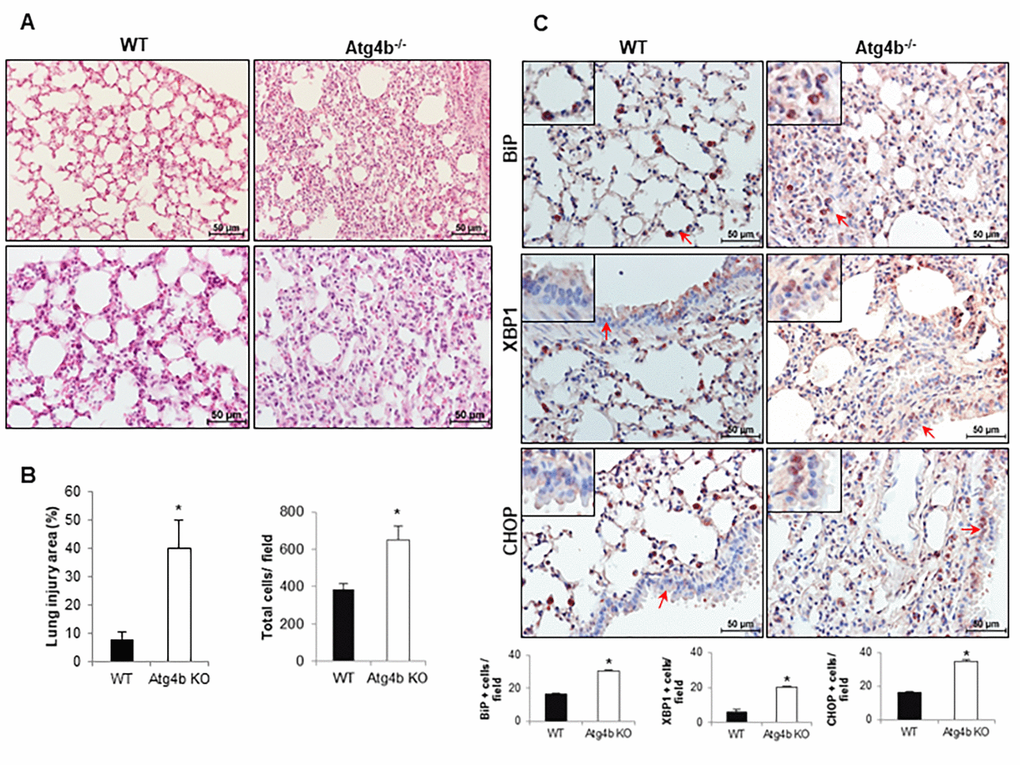 Exacerbated inflammatory and ER stress response in lungs from Atg4b null mice. (A) Representative light microscopy images of H&E stained lung tissue sections from WT and Atg4b null mice after 3 days post-tunicamycin treatment. (B) Lung injury area and total cell number in the lung fields by quantitative image analysis. (C) Representative light microscopy images of BiP, XBP1 and CHOP positive stained lung tissue sections from WT and Atg4b null tunicamycin-treated mice at 3 days (top panels). All insets show 2X larger magnification. Total number of positive stained cells per high power field (40X) in lung tissue sections by quantitative image analysis (bottom panels). Results shown represent mean ± SD. Statistical significance was determined by Student’s t test (*p 