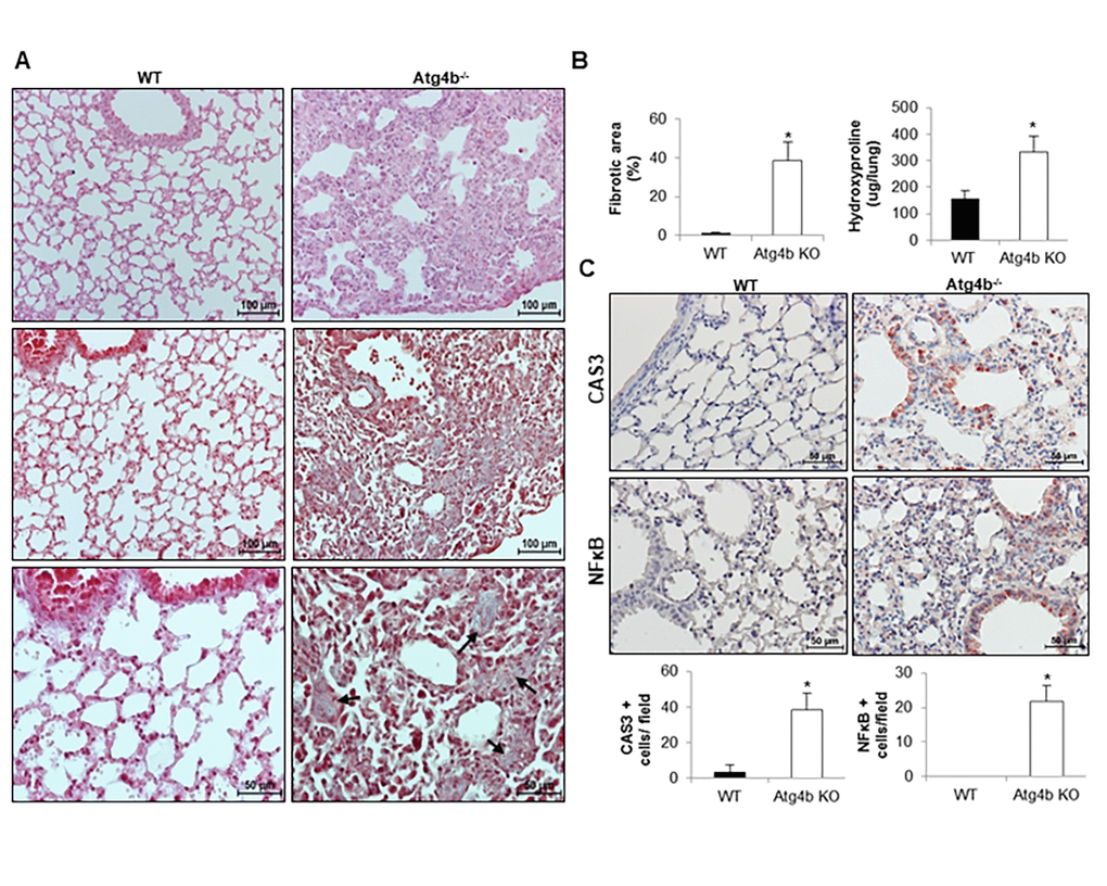 Atg4b deficiency and impaired autophagy sensitizes mice to epithelial apoptosis and lung fibrosis. (A) Representative light microscopy images of H&E and Masson’s trichrome stained lung tissue sections from WT and Atg4b null mice at 21 days post-tunicamycin instillation. (B) Fibrosis extent percentage of damaged tissue area in the lung fields by quantitative image analysis and hydroxyproline content in lungs from tunicamycin-treated WT and Atg4b null mice. (C) Representative light microscopy images of NFκB and CAS3 positive stained lung tissue sections from WT and Atg4b null tunicamycin-treated mice at 21days (top panels). Total number of positive stained cells per high power field (40X) in lung tissue sections by quantitative image analysis (bottom panels). Results shown represent mean ± SD. Statistical significance was determined by Student’s t test (*p 