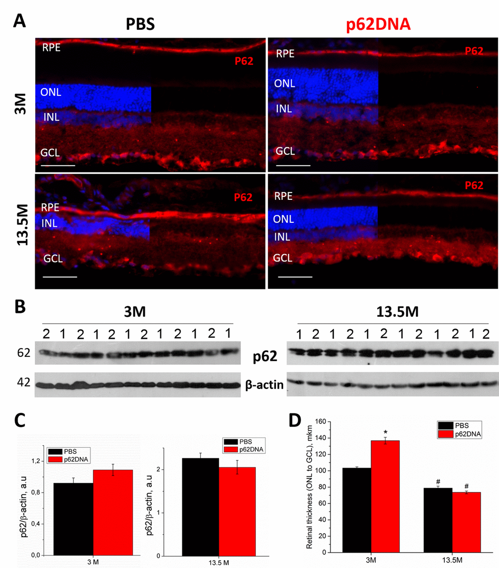 Effect of p62 DNA on p62 expression in the retina of OXYS rats at 3 and 13.5 months. (A) Representative p62 immunofluorescence of retinal cryosections from 3- and 13.5-month-old OXYS rats treated by PBS (left) or p62DNA plasmid (right). Scale bar: 50 μm. RPE: retinal pigment epithelium; ONL: outer nuclear layer; INL: inner nuclear layer; GCL: ganglion cells layer. (B) Representative immunoblots of p62 in the retina of OXYS rats. 1 - PBS; 2 - p62DNA. (C) Levels of p62 protein by immunoblot. (D) Measurements of retinal thickness (from ONL to GCL) in 3- and 13.5-month-old OXYS rats treated by p62DNA or PBS. *p 