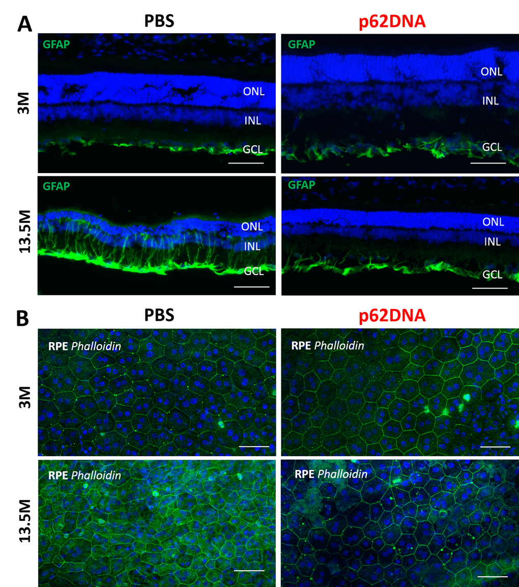 Effect of p62DNA on the GFAP expression and the state of RPE cells. (A) Representative GFAP immunostaining in retina of 3- and 13.5-month-old OXYS rats, treated by PBS (left) or p62DNA (right). GFAP staining was mainly confined to astrocytes and the ganglion cell layer at the inner limiting membrane in OXYS rats at the age of 3 months. In PBS-treated 13.5-month-old OXYS rats, the increased GFAP expression was observed along the Müller glial cell processes extending towards the outer limiting membrane, representing massive gliosis. p62DNA treatment prevented GFAP accumulation in 13.5-month-old OXYS rats. Scale bar: 50 μm. ONL: outer nuclear layer; INL: inner nuclear layer; GCL: ganglion cells layer. (B) Representative images of phalloidin-stained RPE flat-mounts of 3- and 13.5-month-old OXYS rats, treated by PBS (left) or p62DNA (right). p62DNA treatment slowed down development of the destructive alterations of RPE cells (the loss of regular hexagonal shape, the hypertrophy, the multinucleation) in OXYS rats. Scale bar: 50 μm.