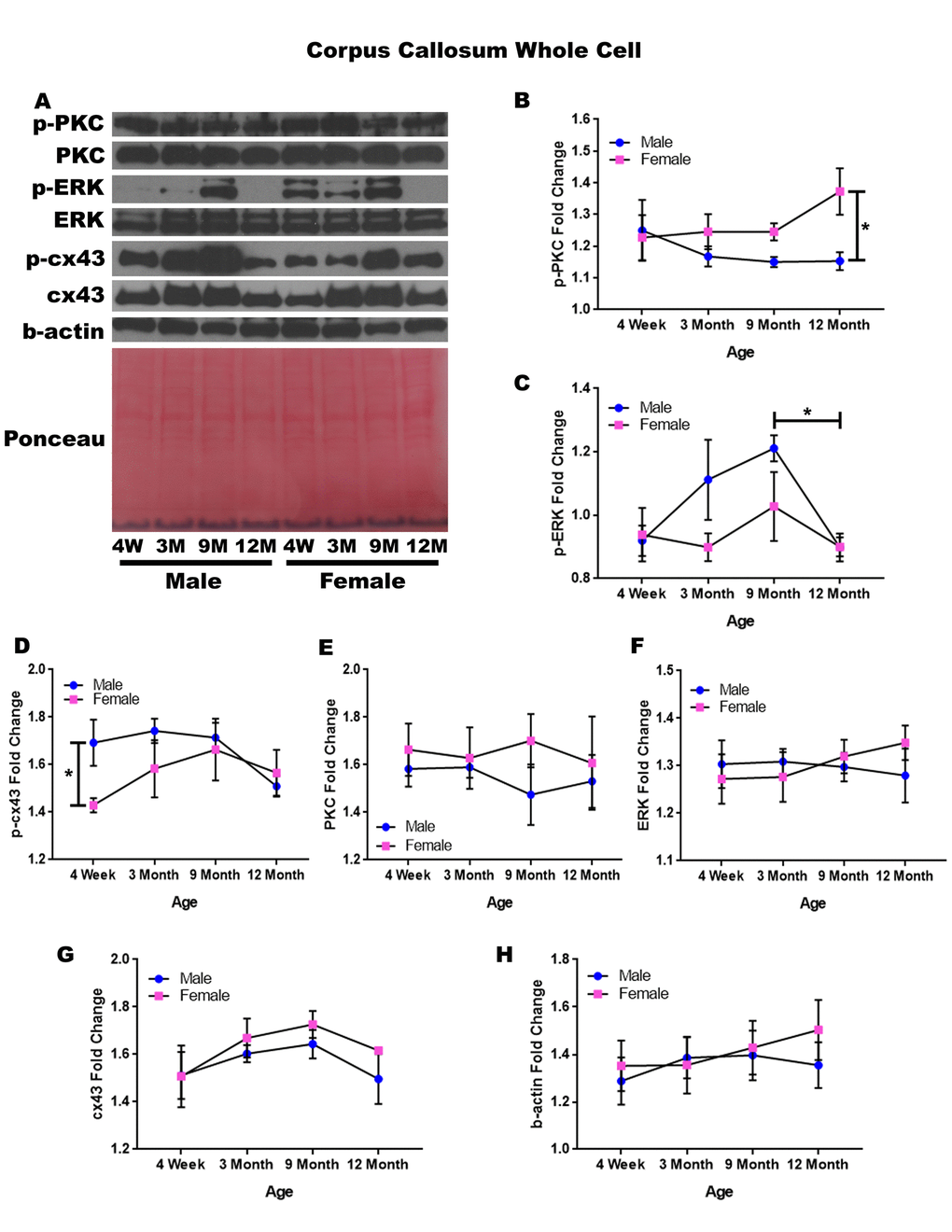 Signaling downstream of estrogen in the corpus callosum across age and gender. Representative western blots for each protein of interest and a representative Ponceau stain as a load control (A). Graphical depiction of the fold change for p-PKC (B), p-ERK (C), p-cx43 comparing gender (D), PKC (E), ERK (F), cx43 (G), beta-actin (H). Error bars = SEM. 4W = 4 weeks of age; 3M = 3 months of age; 9M = 9 months of age; 12M = 12 months of age. Pink = female; blue = male. ANOVA with Tukey posthoc, * = P