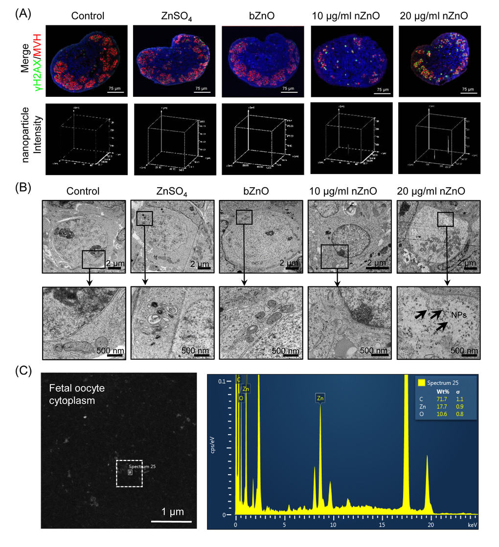 Internalization of nZnO in fetal oocytes. (A) Up: confocal reflection imaging of tissue sections of ovaries cultured for 6 days stained for MVH (red) and Hoechst 33342 (blue); nZnO was reflected and visualized as white dots. Down: 3-D plotting of nZnO intensity is presented with the z-axis indicating the intensity of nZnO within the ovary section and the interface of the x- and y-axes indicating the whole ovary section. (B) Ovary sections observed at TEM; NPs are not detectable in the control, ZnSO4 or bZnO whereas nZnO are recognizable as black particle in the oocyte cytoplasm (arrows). N: nucleus; C: cytoplasm. (C) Chemical characterization of nZnO nanoparticles with TEM equipped with energy dispersive spectrometer (EDX) within the oocyte cytoplasm.