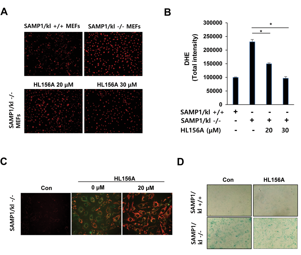 Effects of HL156A on ROS production, mitochondrial membrane potential, and aging in SAMP1/kl-deficient MEFs. (A, B) ROS production in SAMP1/kl+/+ and SAMP1/kl-/- MEFs. ROS levels were measured in SAMP1/kl+/+ and SAMP1/kl-/- MEFs treated with/without HL156A (20 or 30 μM). Cells were viewed using fluorescence microscopy. The graph was derived from 3 independent experiments. (C) Effect of HL156A on mitochondrial membrane potential activity in SAMP1/kl-/- MEFs. Cells were incubated with 20 μM HL156A for 24 h, and the level of the fluorogenic probe JC-1 was then determined to analyze mitochondrial membrane potential. (D) Effect of HL156A on aging in SAMP1/kl-/- MEFs. SAMP1/kl-/- MEFs were exposed to 20 μM HL156A for 24 h. Cell senescence was analyzed with senescence-associated β-galactosidase (SA-β-gal) staining.
