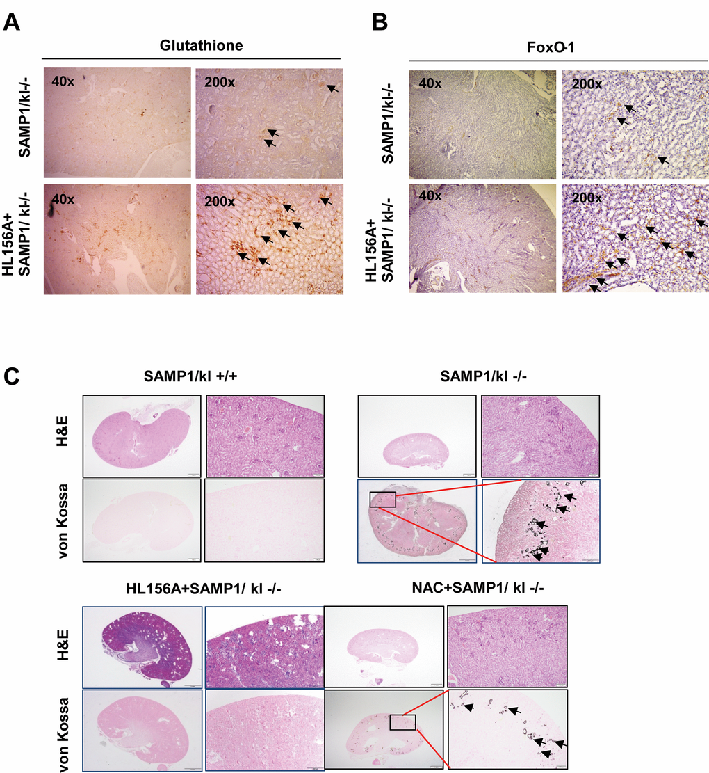 Histological features of the kidneys of HL156A-treated SAMP1/kl-/- mice. (A, B) Changes in glutathione and FOXO1 levels in the kidneys of HL156A-treated SAMP1/kl-/- mice (original magnification x40 or x200). (C) Representative sections were labeled with von Kossa stain. Photomicrographs of kidneys of SAMP1/kl-/- and HL156A- or nicotinamide (NAC)-treated SAMP1/kl-/- mice. Kidney tissue sections were evaluated using von Kossa staining to identify calcium deposits.