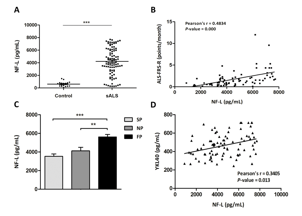 (A) Quantification of NF-L protein levels in the CSF in sALS (n=85) and control (n=23) cases. (B) Positive correlation between ALS-FRS-R slope (point/month) and NF-L levels (pg/mL) (Pearson’s correlation, P=0.000). (C) Higher NF-L protein levels in the CSF are found in cases with fast progression (FP) when compared with cases with slow and normal progression (SP and NP, respectively; P = 0.000, P = 0.005). (D) Positive correlation between YKL40 levels (pg/mL) and NF-L levels (pg/mL) (Pearson’s correlation, P=0.013).