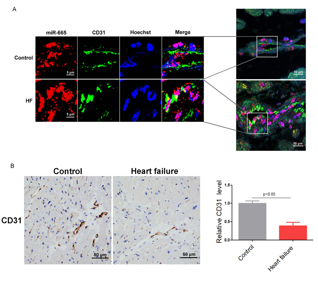 MiR-665 aggravates heart failure via suppressing CD34-mediated