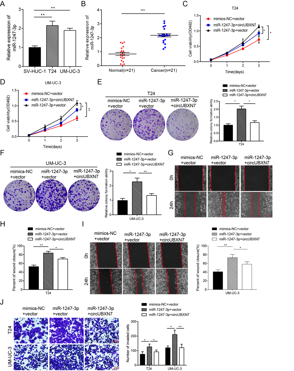 CircUBXN7 reversed the miR-1247-3p-induced increase in proliferation, migration and invasion in BC cells. (A) Relative expression of miR-1247-3p in BC cell lines was examined by qRT-PCR. (B) qRT-PCR analysis of miR-1247-3p expression in BC and normal tissues. (C and D) MTS assay indicated that miR-1247-3p elevated cell viability of BC cells and the effect was abolished by circUBXN7. (E and F) Colony formation assay showed that miR-1247-3p increased clone numbers of BC cells and the effect was relieved by circUBXN7. (G-I) Wound healing assay revealed that miR-1247-3p enhanced the migratory ability of BC cells and this effect was abrogated by circUBXN7. Scale bar, 500 μm. (J) Transwell Matrigel invasion assay demonstrated that miR-1247-3p augmented the invasive capacity of BC cells and this effect was eliminated by circUBXN7. Scale bar, 200 μm. *PPP