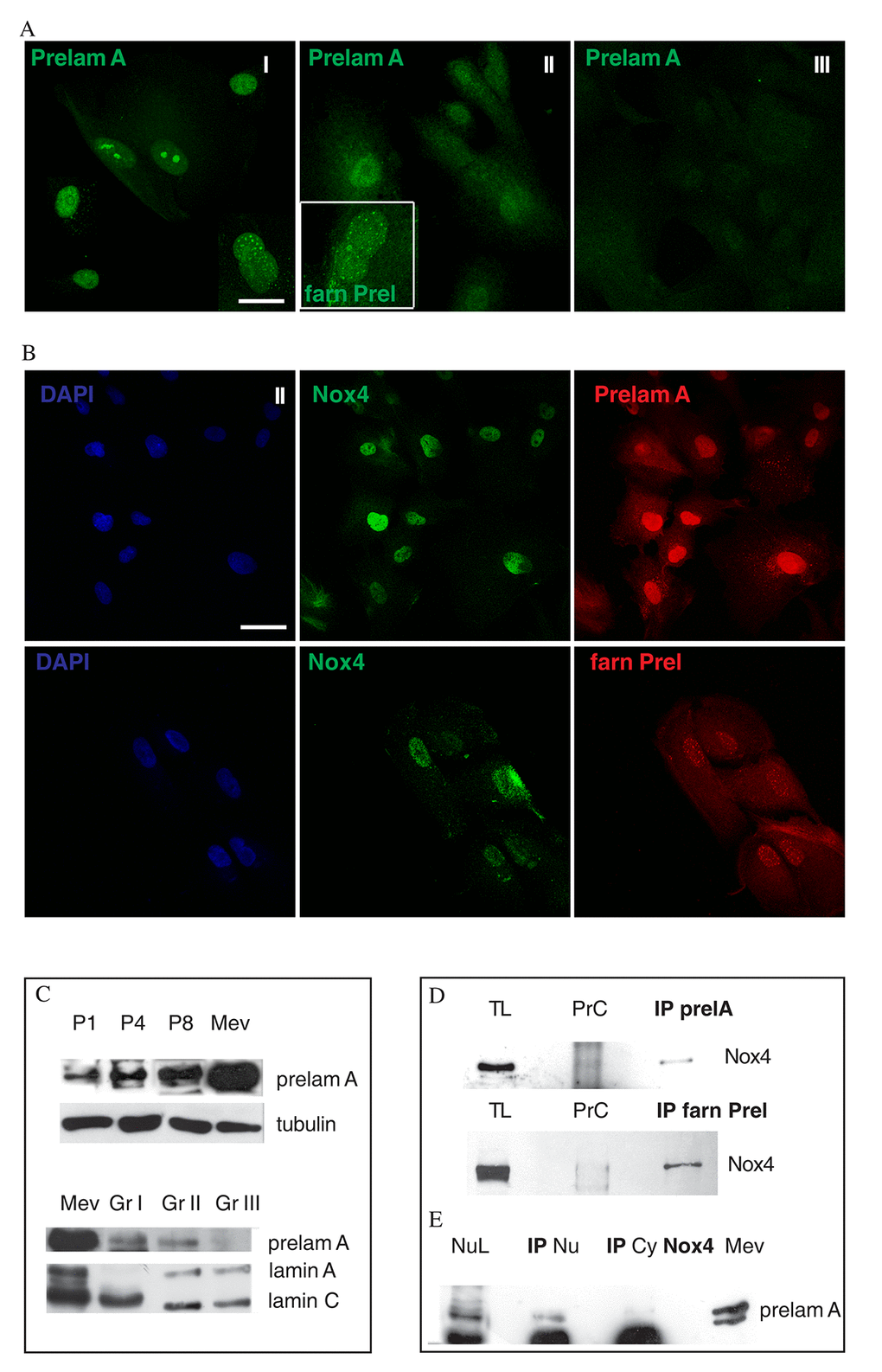 Nox4 interaction with prelamin in nuclei of AFSC. (A) Representative images of AFSC group I, II and III (faster to slower senescent cells) showing green signals of Prelamin A (Prelam A), and, in doubled magnification image in white square of group II, farnesylated Prelamin A (farn Prel). Scale bar= 10 µm. (B) Representative images of AFSC group II labelled with DAPI (blue), Nox4 (green) and Prelamin A (red) or farnesylated Prelamin A (red). Scale bar=10 µm. (C) Western Blot analysis revealed with anti-Prelamin A or the specific anti-Lamin A/C antibodies of total hAFSCs lysates of group II at passage 1, 4 and 8 and of group I, II and III at passage 4. Tubulin detection was performed as a loading control. Mevinolin (Mev) treatment was performed to show a prelamin A positive control. Data are representative of three independent experiments. (D) Western blot analysis of total lysate (TL) and immunoprecipitation (IP) experiment of TL with Prelamin A or farnesylated Prelamin A antibody then revealed with anti-Nox4. Preclearing samples were also loaded, in order to exclude non-specific signals. Data are representative of three independent experiments.(E) Western blot analysis of nuclear lysate (NL) and immunoprecipitation experiment of Nuclear lysate (IP Nu) and Cytoplasmic lysate (IP Cy) with Nox4 antibody then revealed with anti-Prelamin A. Mevinolin (Mev) treatment was performed to show a prelamin A positive control. Data are representative of three independent experiments.