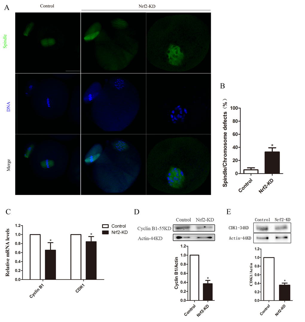 Effects of Nrf2 knockdown on spindle structure, chromosome alignment, Cyclin B1 and CDK1 levels of mouse oocytes. (A) Control and Nrf2-KD oocytes were collected and stained for visualizing spindle (green) and chromosomes (blue). Scale bar, 20 μm. (B) Quantiﬁcation of control and Nrf2-KD oocytes with spindle defects or chromosome misalignment. (C) The relative mRNA level of Cyclin B1 and CDK1 were determined by RT-qPCR in control and Nrf2-siRNA injected oocytes. mRNA levels in control oocytes were set to 1. (D) Western blot analysis showing the reduced expression of Cyclin B1 after Nrf2 siRNA injection. (E) Decreased CDK1 protein levels in Nrf2-KD oocytes. Data are expressed as the mean ± SD, *P