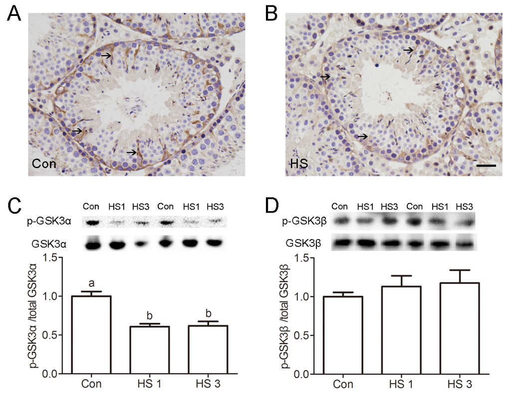 Heat shock-induced dephosphorylation of GSK3α in Sertoli cells. (A-B) Representative microscopic images of p-GSK3α in control (A) and heat shock (HS) treated (B) mouse testis evaluated by immunohistochemistry. Arrows indicate p-GSK3α-positive spermatocytes. Scale bar=50 μm. (C) Western blots and histogram showing the protein levels of p-GSK3α and GSK3α in mouse testis after heat shock. (D) Western blots and histogram showing the protein levels of p-GSK3β and GSK3β in mouse testis after heat shock. Con, control; HS, heat shock. Values are expressed as the mean±SEM, n=6. Values with different superscripts are significantly different from each other (P