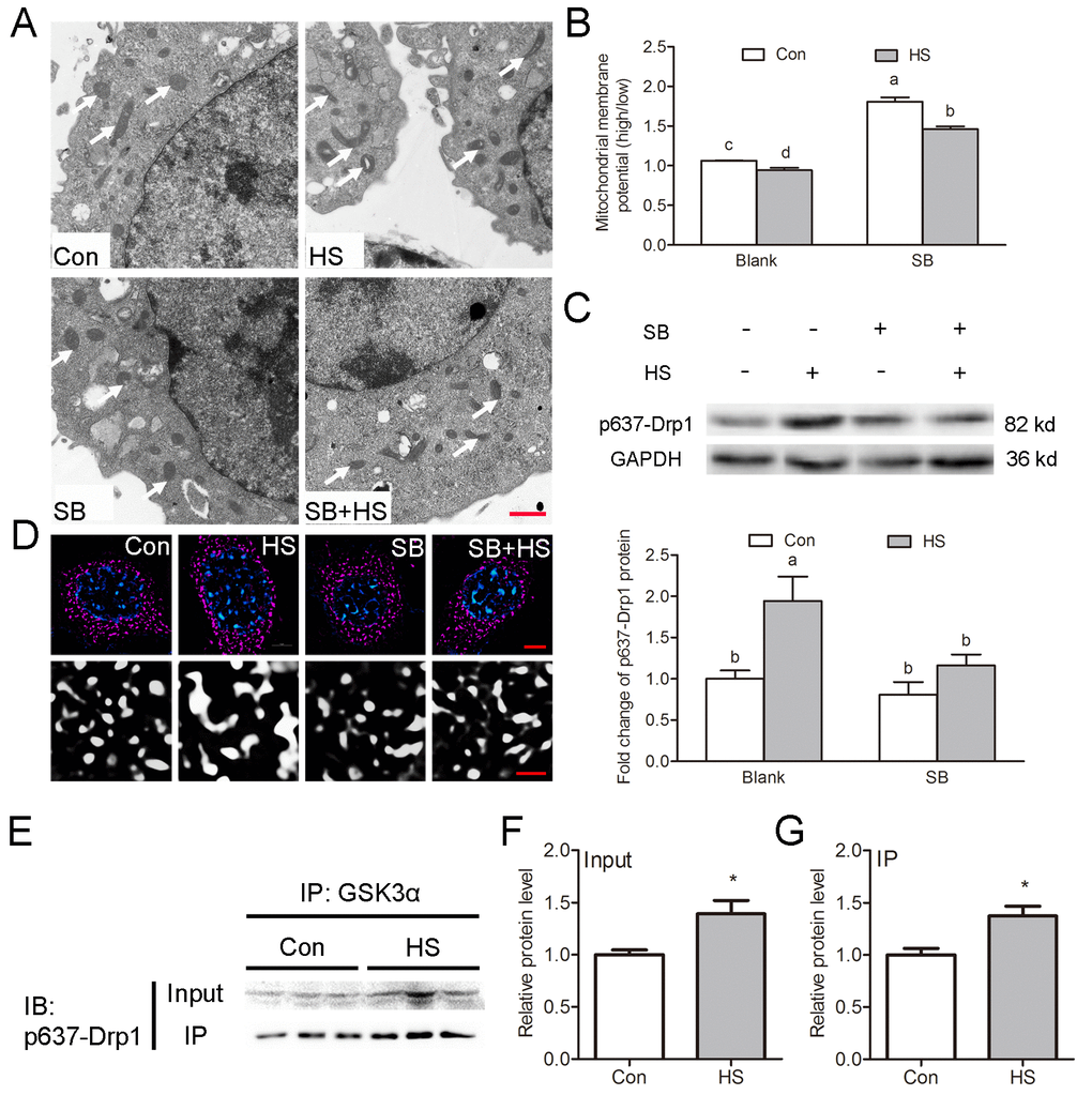 GSK3α activation inhibits mitochondrial fission through phosphorylation of Drp1 at Ser637 in Sertoli cells. (A) Representative electron microscopic images of mitochondrial ultrastructure in TM4 cells treated with HS or GSK3α inhibitor. Arrows indicate mitochondria. Scale bars=1 μm. (B) Histogram showing ΔΨm in TM4 cells by JC-1 staining and flow cytometric analysis (C) Western blots and histogram showing the protein levels of Ser637-Drp1 in TM4 cells treated with HS or GSK3α inhibitor. (D) Representative immunofluorescence images of mitochondria (red) in TM4 cells treated with HS or GSK3α inhibitor. (E-G) Immunoprecipitation of Ser637-Drp1 with anti-GSK3α in TM4 cell followed by immunoblotting analysis to demonstrate the stimulatory effects of HS on the interaction between GSK3α and Ser637-Drp1. Con: control; HS: heat shock; SB: SB216763. Scale bars=1 μm. Values are expressed as the mean±SEM, n=6. Values with different superscripts are significantly different from each other (P