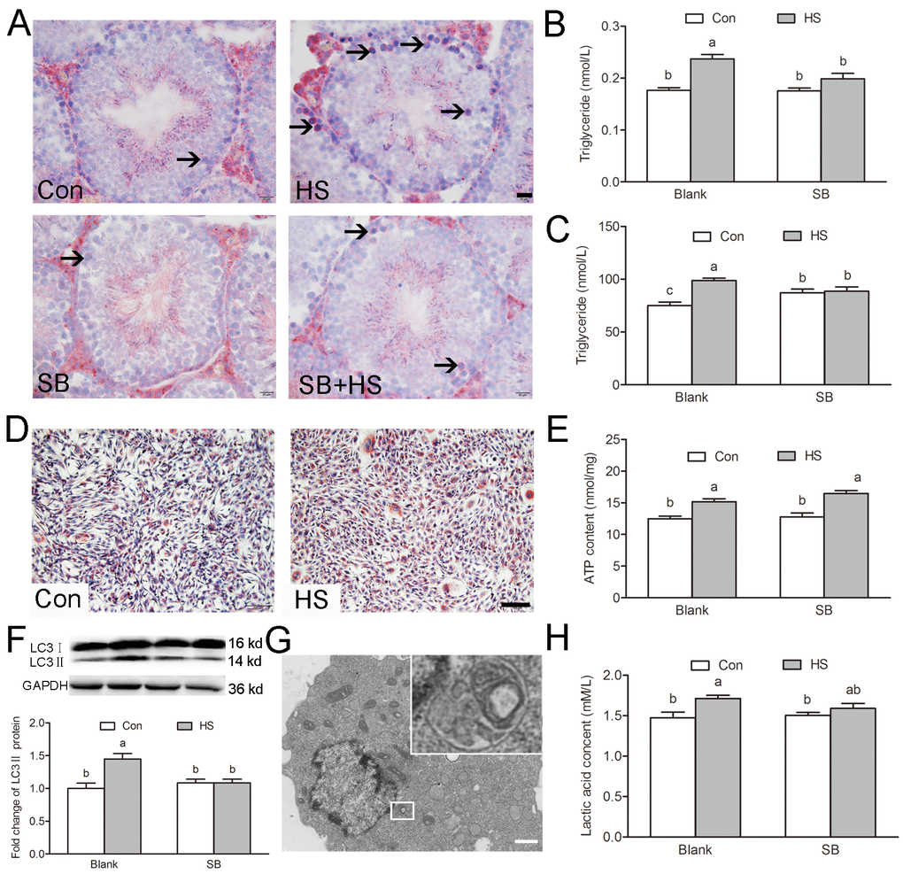 GSK3α activation participates in HS-induced Sertoli cells lipid droplets accumulation. (A) Representative microscopic images of lipid droplet formation in mouse testis treated with HS or GSK3α inhibitor. ORO stained lipid droplets are shown in red (arrows). Scale bars=20 μm. (B) Histogram showing quantification of TG content in mouse testis treated with HS or GSK3α inhibitor. (C) Histogram showing quantification of TG content in TM4 cells treated with HS or GSK3α inhibitor. (D) Representative microscopic images of lipid droplet formation in TM4 cells. Scale bars=50 μm. (E) Histogram showing quantification of ATP content in TM4 cells treated with HS or GSK3α inhibitor. (F) Western blots and histogram showing the protein levels of LC3 in TM4 cells. (G) Representative electron microscopic images of autophagosome structure in TM4 cells. (H) Histogram showing quantification of lactic acid content in TM4 cells treated with HS or GSK3α inhibitor. Con: control; HS: heat shock; SB: SB216763. Values are expressed as the mean±SEM, n=6. Values with different superscripts are significantly different from each other (P