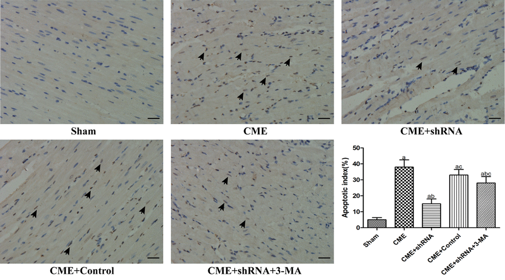 Inhibition of Egr-1 decreased the myocardial AI following CME. TUNEL staining of the microinfarcted myocardium stained the apoptotic nuclei yellow-brown, while the normal nuclei were stained light blue. The arrows indicate apoptotic nuclei (x400, scale bar = 25 μm). The results are presented as the means ± SD from at least three independent experiments. aP bP cP 