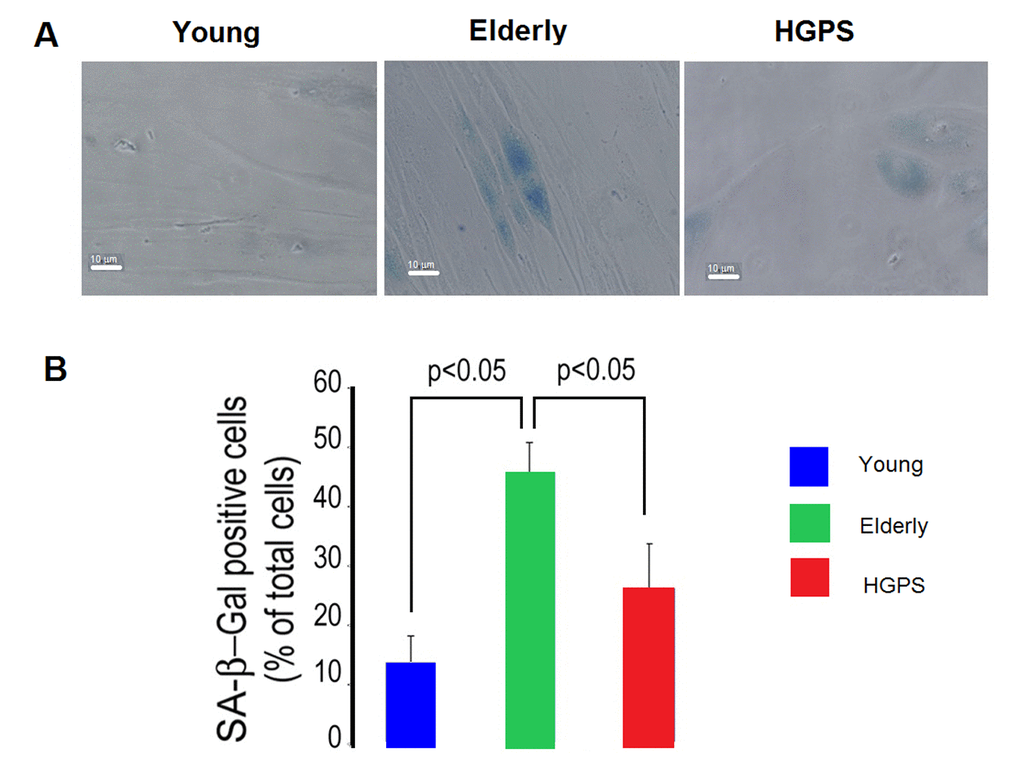 Percentage of senescent cells. (A) Representative micrographs of isolated hDF obtained from young, elderly and HGPS donors. Cells with blue staining indicated positive for SA β-galactosidase activity. Images acquired in transmission light bright field at 400× magnification. Scale bar: 10 μm. (B) The percentages of positive hDF from Young, Elderly and HGPS groups are reported in the graph as mean value of three independent staining (% ± STD). Significant differences calculated according to the Student’s t-test (p