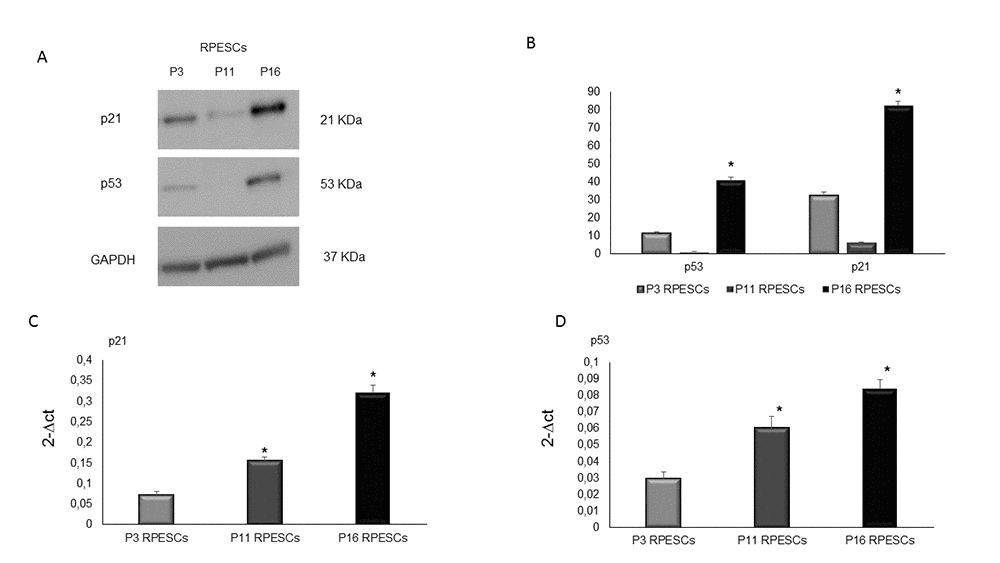 Human p53 and p21 protein expression levels in senescent and young RPESCs. p53 and p21 protein expression levels (A) Western blot analysis (B) and densitometric analysis of blots. Data are mean ± SD of 3 independent experiments. *P = from 0.022 to 0.046. (C) Relative expression levels of mRNA related to p21 and (D) p53 genes in young (P3), pre-senescent (P11) and senescent (P16) RPESCs cells. Data are mean ± SD of 3 independent experiments. *P = from 0.031 to 0.044.