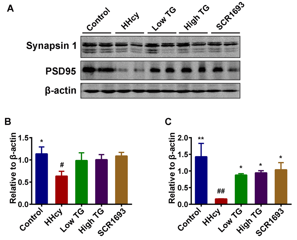 TG supplementation attenuated the decrease of memory-related proteins. (A) Levels of synapsin 1 and PSD95 were detected using western blotting technique in the hippocampus and β-actin was used as loading control. (B and C) Quantitative analysis of the blots showed that Hcy dramatically decreased the expression of these synaptic proteins in the hippocampus when compared with control group, and treatment with TG reversed these effects. The data were expressed as mean ± SEM (n = 6). # P 
