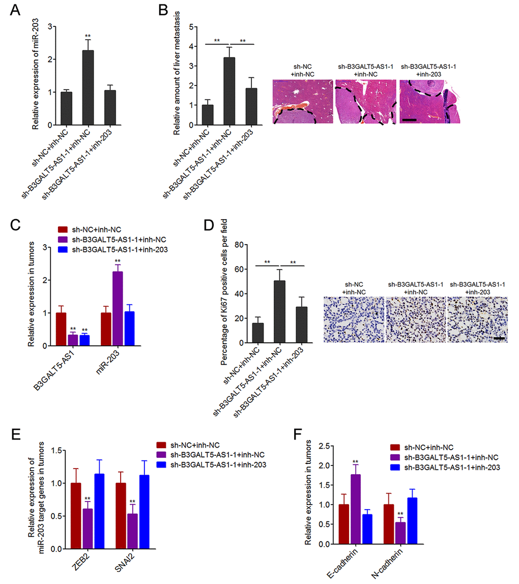Depletion of B3GALT5-AS1 promoted colon cancer liver metastasis in a miR-203-dependent manner. (A) miR-203 expression in B3GALT5-AS1 and miR-203 concurrently depleted and control SW620 cells was measured using qRT-PCR. Data are displayed as mean ± s.d. of three independent experiments. **P t-test. (B) B3GALT5-AS1 and miR-203 concurrently depleted and control SW620 cells were intra-splenic injected to establish liver metastasis. The amount of liver metastatic foci was detected at the 42th day after intra-splenic injection using HE staining. Scale bars = 1000 μm. (C) The expression of B3GALT5-AS1 and miR-203 in liver metastatic foci formed by B3GALT5-AS1 and miR-203 concurrently depleted and control SW620 cells was detected using qRT-PCR. (D) Immunohistochemical staining of Ki67 in liver metastatic foci formed by B3GALT5-AS1 and miR-203 concurrently depleted and control SW620 cells. Scale bars = 50 μm. (E) The expression of ZEB2 and SNAI2 in liver metastatic foci formed by B3GALT5-AS1 and miR-203 concurrently depleted and control SW620 cells was measured using qRT-PCR. (F) The expression of E-cadherin and N-cadherin in liver metastatic foci formed by B3GALT5-AS1 and miR-203 concurrently depleted and control SW620 cells was detected using qRT-PCR. For B-F, data are displayed as mean ± s.d. of six mice in each group. **P 
