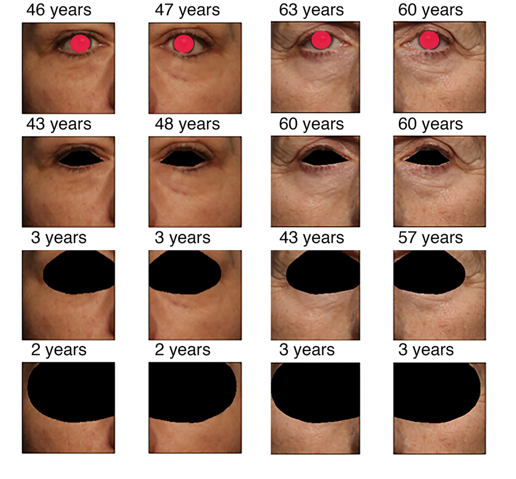 Predicted age vs. the extent of occlusion for two persons. Picture order (up to bottom): original, covered eye area, eyelid and corner covered, and half image area covered. See text for clarifications. Real chronological age for the left subject is 50 years, for the right subject is 62 years.