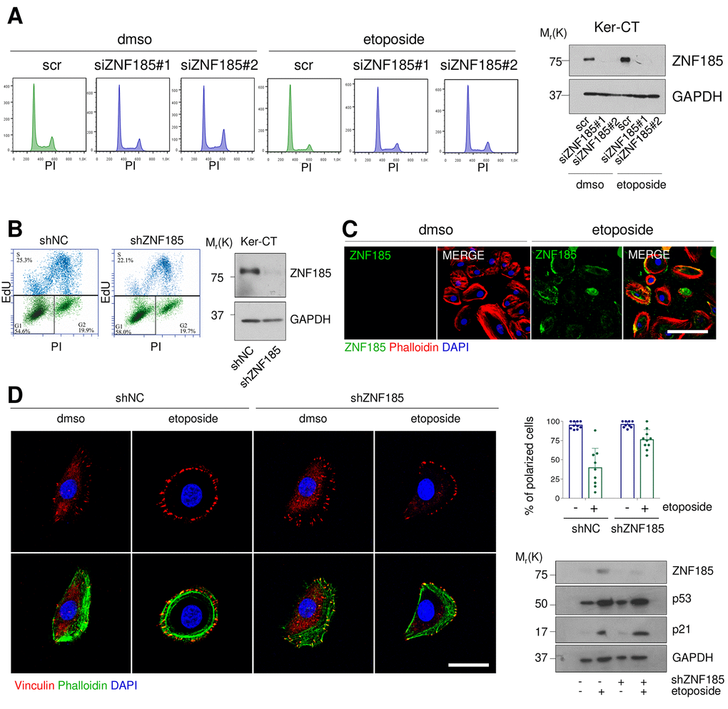 ZNF185 is involved in the cytoskeleton remodelling upon DNA damage. (A) FACS analysis of cell cycle content of the Ker-CT treated with either DMSO or 100 µM etoposide for 24 h after ZNF185 knock-down with two different siRNAs. Western blot confirms ZNF185 silencing. (B) EdU-incorporation assay by FACS showing % of EdU-positive Ker-CT shZNF185 cells. Western blot confirms the ZNF185 knock-down. (C) Immunofluorescence analysis of ZNF185 expression in Ker-CT treated with either DMSO or 100 µM etoposide for 16 h. Phalloidin was used for cytoskeleton staining. Scale bar: 50 µm. (D) Immunofluorescence analysis of vinculin distribution in Ker-CT treated with either DMSO or 100 µM etoposide and knocked-down for ZNF185. Phalloidin was used for cytoskeleton staining. Scale bar: 20 µm. In the right panel is shown the quantification of % of polarized cells in ten random fields. Western blot shows ZNF185, p53, and p21 levels.