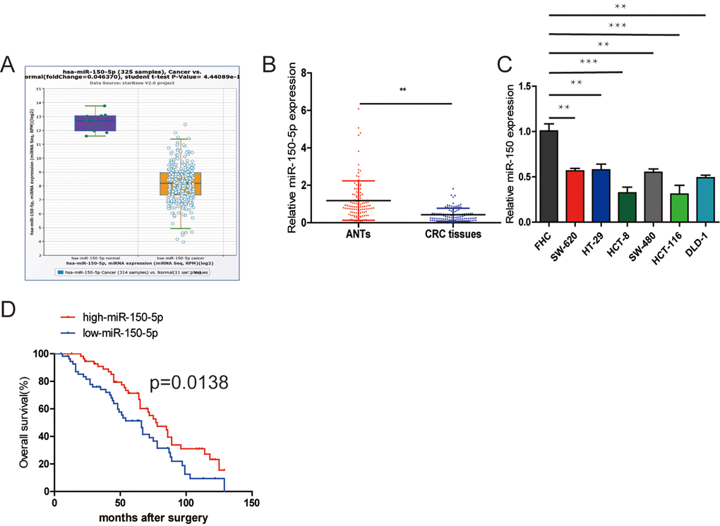 Downregulation of miR-150-5p in CRC and its association with poor OS. (A) miR-150-5p was found to be downregulated compared with normal tissues in the Starbase database. (B) Quantitative RT-PCR was performed to detect the relative expression of miR-150-5p in CRC tissues compared with ANTs. (C) The relative expression of miR-150-5p was assessed in different CRC cell lines and FHC using qRT-PCR. (D) Kaplan-Meier survival analysis was employed to detect the correlation between the levels of miR-150-5p expression and overall survival of CRC patients. Data were shown as mean±SD. **p