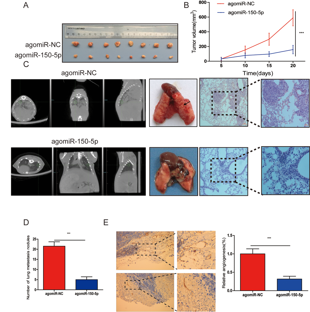 miR-150-5p inhibited tumor growth, metastasis and angiogenesis in vivo. (A) Photographs of nude mice and xenograft tumors of CRC cells with miR-150-5p overexpression or not after 20 days of implantation. (B) Growth curves of xenografts of CRC cells with or without miR-150-5p overexpression. (C) The representative images of lungs from nude mice (left), representative CT scans of lung metastatic foci of the nude mice (middle) and the microscopic images of lung tissue sections stained by hematoxylin and eosin (right). (D) A statistical plot of the average number of lung metastases in the tail vein injection. (E) These tumor tissues were stained using anti-CD31 antibody, data are shown as the mean ±SD. n=8. ***p