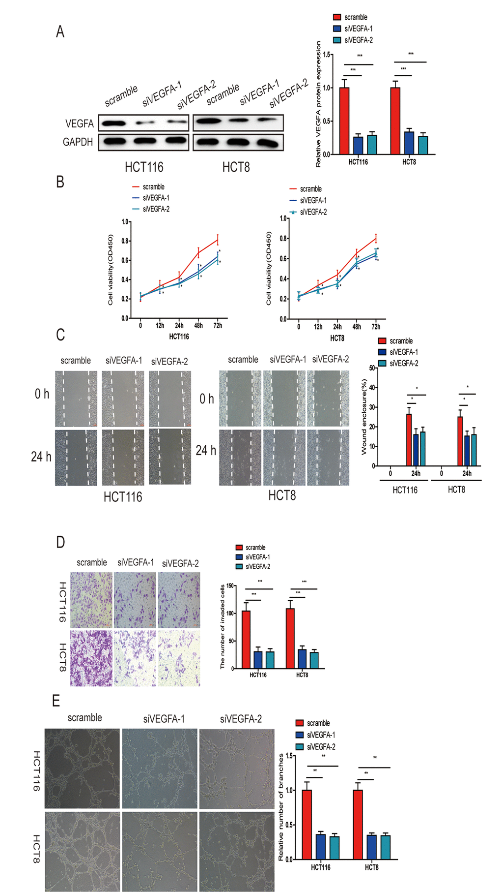 VEGFA knockdown significantly inhibited CRC progression. (A) VEGFA expression was downregulated in HCT116 and HCT8 cells transfected with siVEGFA-1 or siVEGFA-2. (B) VEGFA knockdown inhibited CRC cell proliferation (B), migration (C), invasion (D) and HUVECs tube formation (E). Data are shown as the mean±SD of three independent experiments. *ppp