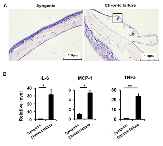 Leukocytes in proximity to murine CE of chronic graft failure. (A) H&E staining showing immune cell infiltration in the murine CE. (B)The expression of senescence-associated secretory phenotypefactor in RNA pooled from murine CE from chronic failure group compared with syngenic group. *PP