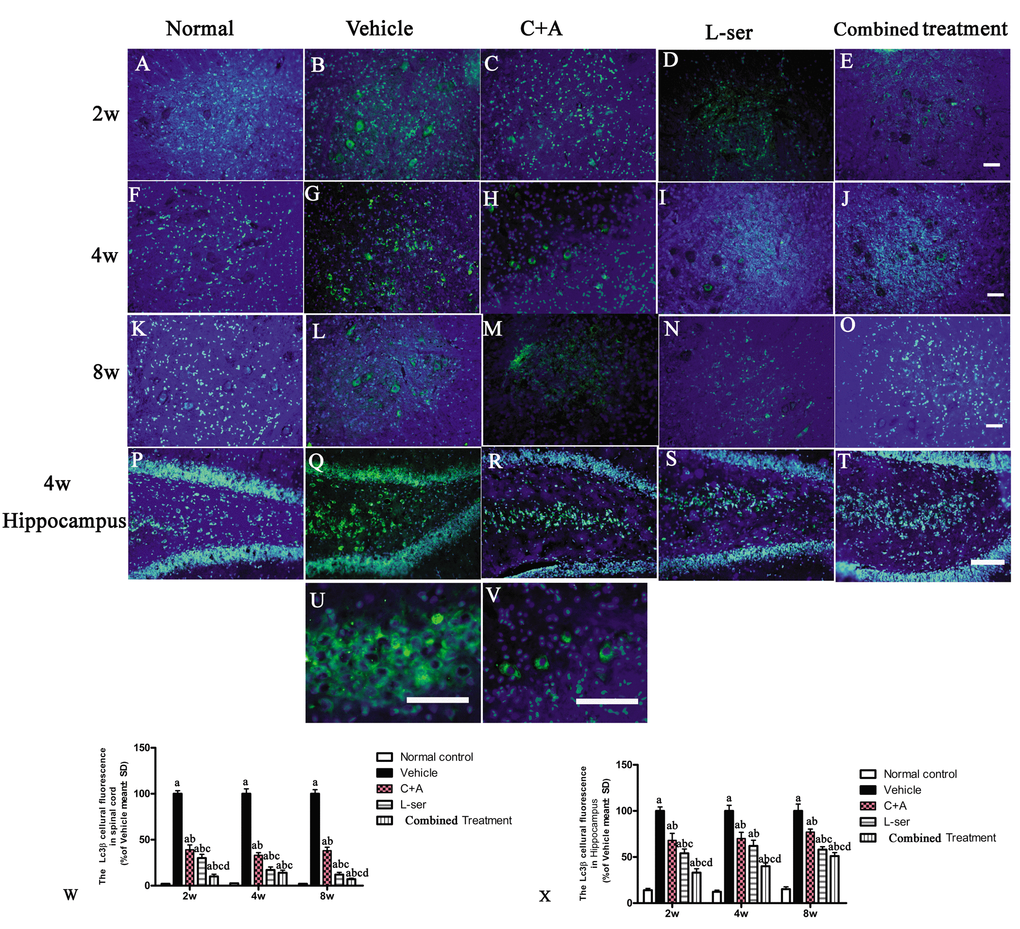 Representative fluorescence microscopy images of the spinal cord anterior horn and hippocampus. LC3B fluorescence appears green and Hoechst 33342 (nucleus stain) appears blue. (A-T) Treatment with C16+Ang1 and L-serine, separately, reversed the up-regulation of LC3 expression compared with vehicle-treated group after L-BMAA injection at different time points, and the combined treatment showed a stronger effect on LC3 expression than either individual treatment group. (U-V) Enlarged images of sections from the hippocampus of the vehicle-treated model group (Q) and from the spinal cord of the C16+Ang-1–treated group (H) show the cytosolic localization of LC3 staining. (W, X) Quantification of relative fluorescence of LC3-positive cells. (a) p