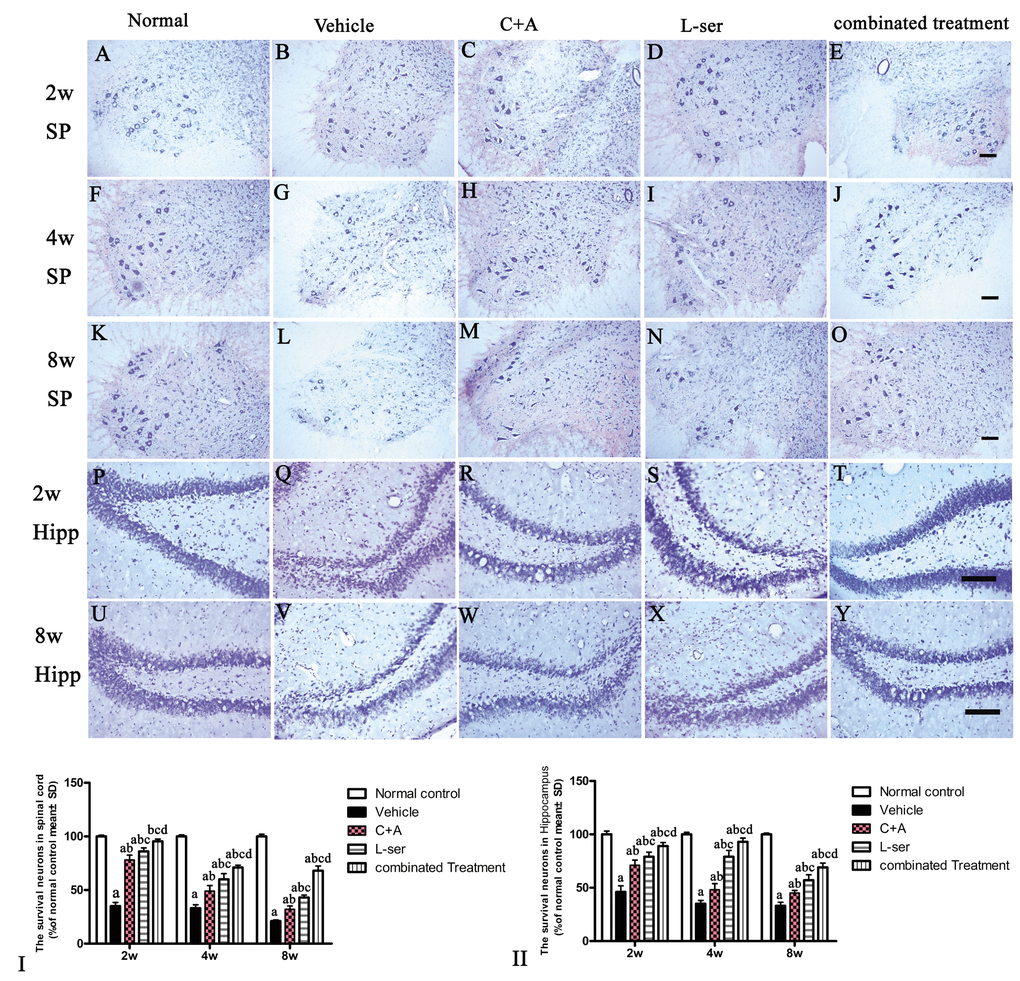 The gradual loss of neurons in the CNS of L-BMAA–treated rats was revealed by Nissl staining. However, the number of surviving neurons was markedly increased by C16+Ang-1 treatment and further still by L-serine treatment. The combined treatment produced the best effects as revealed by cell quantification.SC: spinal cord; H: hippocampi. Scale bar = 100 µm. Neurons were counted in three visual fields per section taken at 200× magnification under bright field viewing. (I-II): The rate of surviving neurons (shown as % of normal control) was calculated based on the neuron number. (a) p