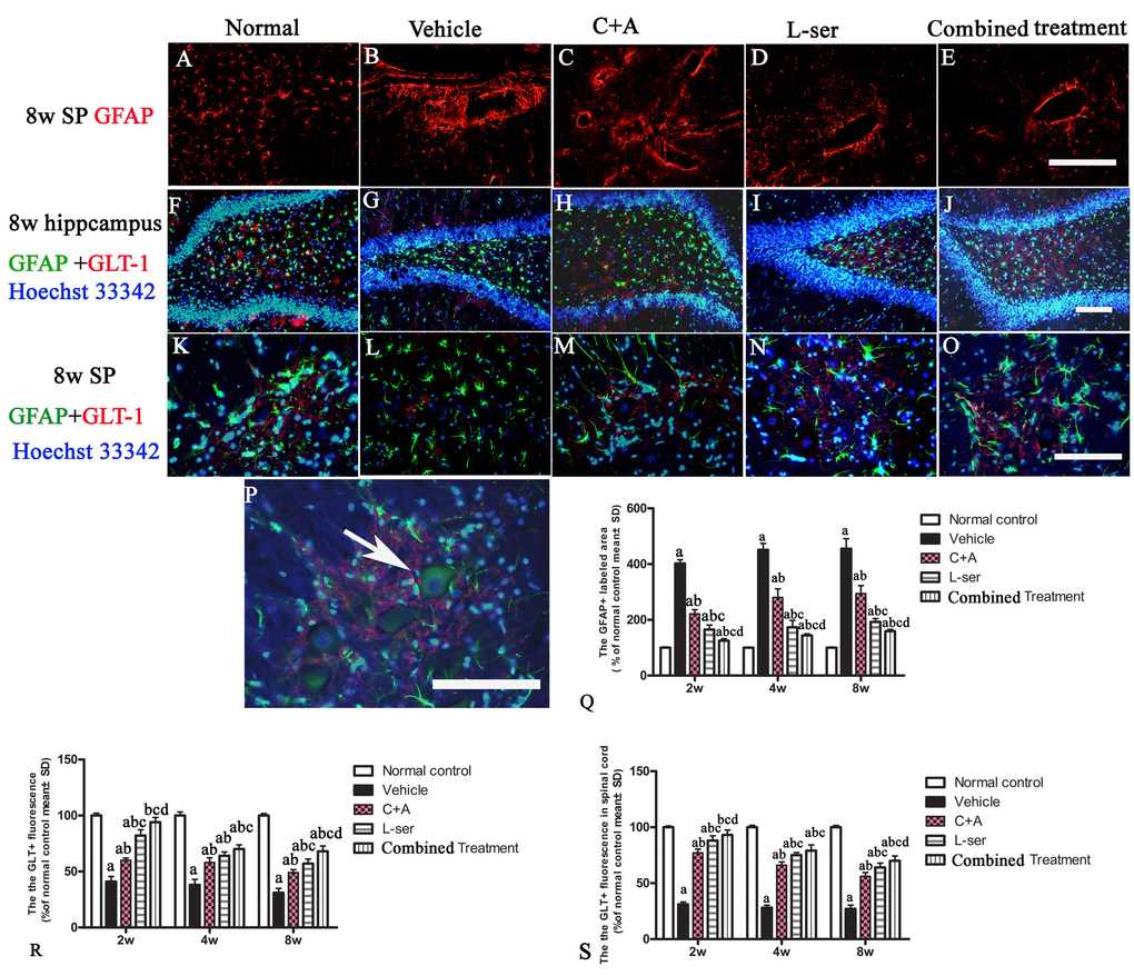 (A-E) Vehicle-treated model rats exhibited pronounced reactive gliosis as revealed by TRITC-conjugated GFAP immunofluorescence staining. SP: spinal cord. (A) Normal astrocytes in the spinal cord. (B) Glial scarring following L-BMAA injection in the vehicle-treated model group. (C-E) C16+Ang-1treatment alleviated reactive astrogliosis. (Q) L-serine treatment resulted in fewer abnormally proliferating astrocytes, and the combined treatment produced more pronounced effects according to cell quantification. (F, K, P) In normal control rats, intense GLT-1 labeling appeared in astrocytes around neurons of the DG region of the hippocampus and ventral horn motor neurons (arrow in P), in contrast to the pronounced decrease in GLT-1 labeling around ventral horn motor neurons in the vehicle-treated model rats. Treatment with C16+Ang-1, L-serine, and especially combined treatment with both results significantly increased expression of GLT-1. Scale bar = 100 μm. (a) p
