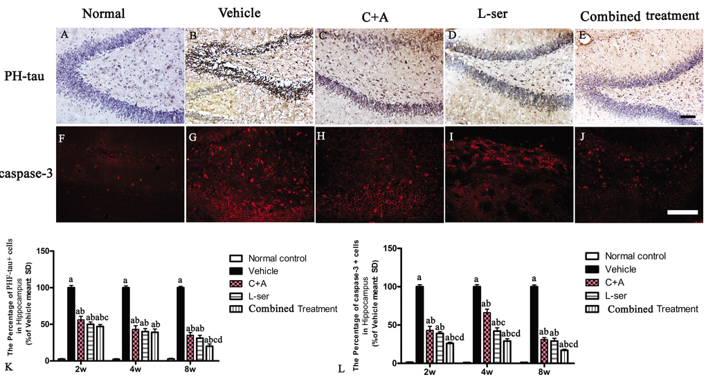 (A-E) Microscopic pathology in L-BMAA–injected vehicle-treated group. Immunostaining showed that hyperphosphorylated (PHF) tau expression was increased in the neurons of the hippocampus and spinal cord anterior horn compared with that in the normal control rats. (B) Enlarged image was inserted to show the positive stained neurons in the vehicle-treated group. (F-J) Caspase-3 expression was increased in the hippocampus after L-BMAA administration as revealed by immunofluorescence staining. (K) C16+Ang-1 and L-serine treatments inhibited the elevated expression of PHF-tau, and the combined treatment showed the most obvious effects. (L) Treatment with C16+Ang-1, L-serine, and especially both obviously reduced the number of caspase-3–positive neurons labeled with red fluorescence. Scale bar = 100 μm (a) p