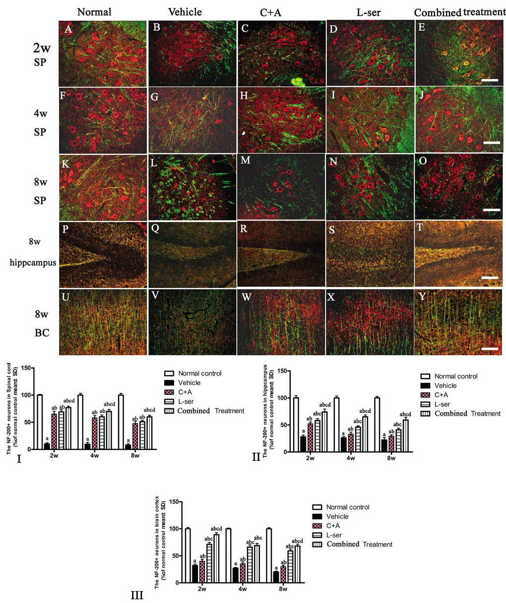 After the rats had received injections of 300 mg/kg BMAA each day for 3 days, morphological changes were observed in the motor neurons of the lumbar ventral horn (A-O), hippocampus (P-T), and brain motor cortex (U-Y) at 2w, 4w and 8w post-injection. NF-200 (red, a specific marker for neurofilament in neurons) and MBP (green, a specific marker for myelin) double immunolabeling, which recognizes neurofilament proteins pivotal for maintaining large neurons with extensively myelinated processes, allowed visualization of changes in somatic and dendritic morphology and revealed structural injury. Scale bar = 100 μm. In the vehicle-treated model group, extensive disintegration of dendritic processes and a lack of NF-200 staining both in somatic and dendrites of neurons as well as atrophy of lumbar ventral horn motor neurons were noted (L); a drastic decrease in NF-200 staining was also discernible at 2 months after L-BMAA injection in the hippocampus (Q) and motor cortex (V). However, C16+Ang-1 and L-serine treatments could attenuate the loss of axons in the CNS after L-BMAA administration, and the combined treatment produced the most pronounced effects. Transverse sections of the anterior horn of the lumbar spine are denoted with SP, and coronal sections of the motor cortex are denoted with BC. (I-III) Quantification of relative fluorescence of NF200-positive cells. (a) p