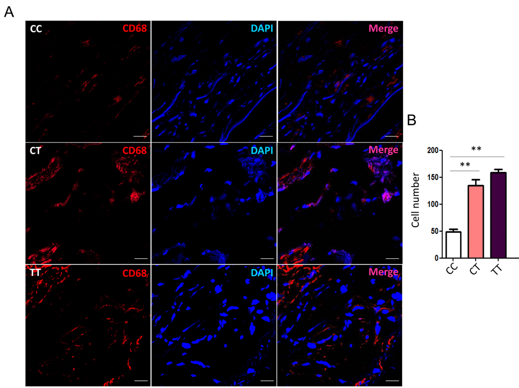 rs12455792 C>T variant promotes MØ infiltration in human thoracic aorta specimens. (A) Representative confocal-microscopy graphs of immunostaining for CD86 in specimens from thoracic aortic aneurysm patients with rs12455792 CC, CT or TT genotypes. Red: CD68; Blue: DAPI. (B) The quantitative analysis of MØ cell numbers in different groups, n=8/group. Data are means ± SD. **P