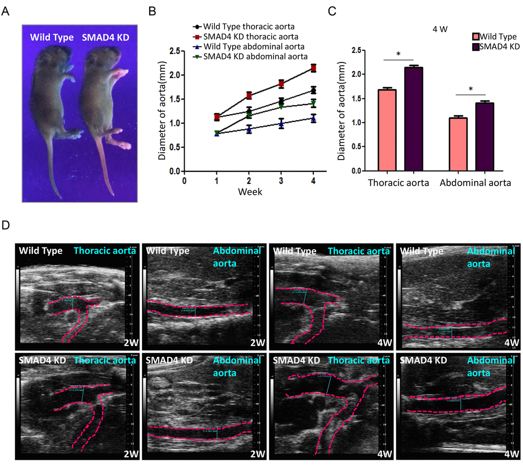 Repression of SMAD4 leads to dilatation of both thoracic aorta and abdominal aorta. (A) Representative holistic view of Wild Type and SMAD4 KD mice under ultraviolet. The red fluorescence is observed in the naked skin of SMAD4 KD mice. (B) The polygram for time-dependent aorta dilatation in different groups; (C) The quantitative analysis for diameter of aortas among different groups at 4W after modeling; (D) Representative echocardiography images of aorta diameter in Wild Type and SMAD4 KD group at 2W or 4W, n=5/group. *: P